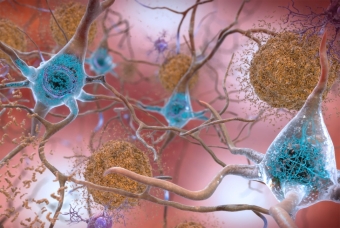 In patients with Alzheimer's disease, tau proteins (shown in light blue) misfold and accumulate inside brain cells. By making a synthetic version of these proteins, researchers aim to better understand disease. Image by the National Institute on Aging